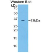 Western blot analysis of recombinant Human ROR1.