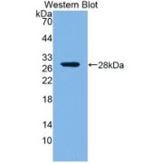 Western blot analysis of the recombinant protein.
