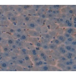 Receptor Tyrosine Kinase Like Orphan Receptor 1 (ROR1) Antibody
