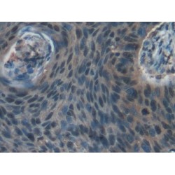 Relaxin/Insulin Like Family Peptide Receptor 1 (RXFP1) Antibody