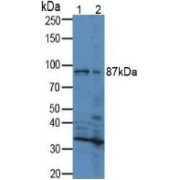 WB analysis of Mouse brain tissue (1) and Mouse kidney tissue (2), using RXFP1 antibody.