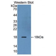 Western blot analysis of recombinant Human RXFP1.