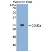 Western blot analysis of recombinant Human SMC3.