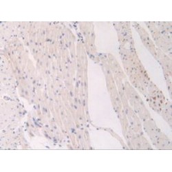 Vascular Endothelial Growth Factor Receptor 1 / VEGFR1 (FLT1) Antibody