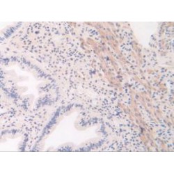 Vascular Endothelial Growth Factor Receptor 1 / VEGFR1 (FLT1) Antibody