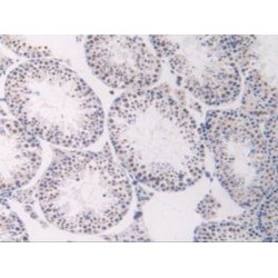 Vascular Endothelial Growth Factor Receptor 1 / VEGFR1 (FLT1) Antibody