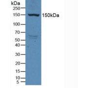Western blot analysis of Rat Serum.
