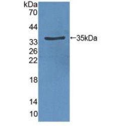 Vascular Endothelial Growth Factor Receptor 2 / VEGFR2 (KDR) Antibody