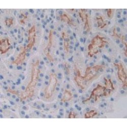 Vascular Endothelial Growth Factor Receptor 2 / VEGFR2 (KDR) Antibody