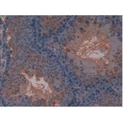 Vascular Endothelial Growth Factor Receptor 3 / VEGFR3 (FLT4) Antibody