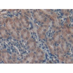 17-Beta-Hydroxysteroid Dehydrogenase Type 12 (HSD17B12) Antibody