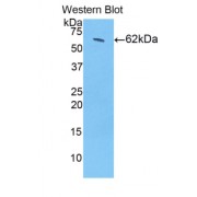 Western blot analysis of recombinant Mouse HSD17b12 Protein.