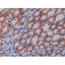 ATPase, Na+/K+ Transporting Beta 1 Polypeptide (ATP1B1) Antibody
