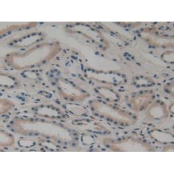 ATPase, Na+/K+ Transporting Beta 3 Polypeptide (ATP1B3) Antibody