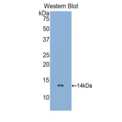 Colony Stimulating Factor Receptor, Granulocyte (GCSFR) Antibody