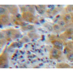 Colony Stimulating Factor Receptor, Granulocyte (GCSFR) Antibody