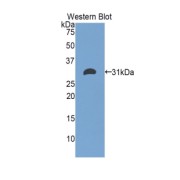 Western blot analysis of the recombinant protein.