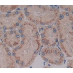 Electron Transfer Flavoprotein Alpha Polypeptide (ETFa) Antibody