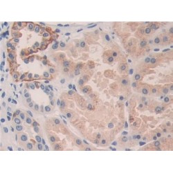 Killer Cell Immunoglobulin Like Receptor 2DL3 (KIR2DL3) Antibody