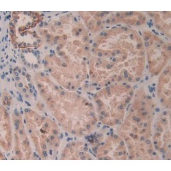 Killer Cell Immunoglobulin Like Receptor 2DL3 (KIR2DL3) Antibody