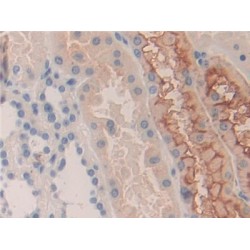 Killer Cell Immunoglobulin Like Receptor 2DS2 (KIR2DS2) Antibody