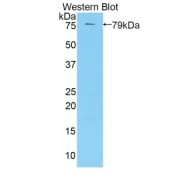 abx104485