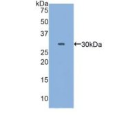 Western blot analysis of recombinant Human MYH3.