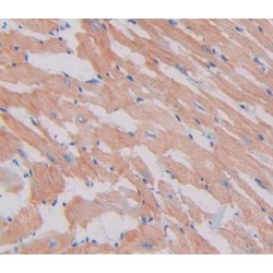 Myosin-3 (MYH3) Antibody