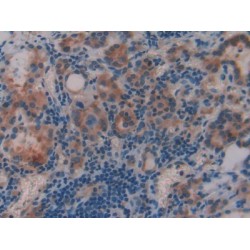 Glucocorticoid Receptor (NR3C1) Antibody