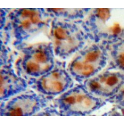 Angiogenic Factor With G Patch And FHA Domains 1 (AGGF1) Antibody