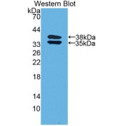 Western blot analysis of the recombinant protein.