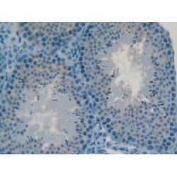 C2 Calcium Dependent Domain Containing Protein 3 (C2CD3) Antibody