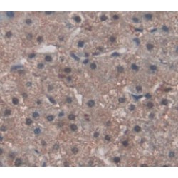 Fibronectin Type III Domain Containing Protein 5 (FNDC5) Antibody