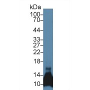Western blot analysis of Mouse Pancreas lysate, using Mouse MRP1 Antibody (5 µg/ml) and HRP-conjugated Goat Anti-Rabbit antibody (<a href="https://www.abbexa.com/index.php?route=product/search&amp;search=abx400043" target="_blank">abx400043</a>, 0.2 µg/ml).