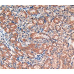 Chemokine (C-C motif) ligand 6 / C10 (CCL6) Antibody