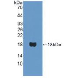 Peroxisome Proliferator Activated Receptor Alpha (PPARa) Antibody