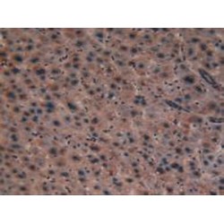 Peroxisome Proliferator Activated Receptor Alpha (PPARa) Antibody