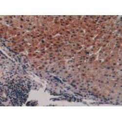 Peroxisome Proliferator Activated Receptor Alpha (PPARa) Antibody