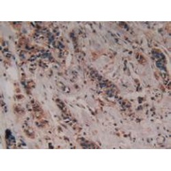Peroxisome Proliferator Activated Receptor Alpha (PPARa) Antibody