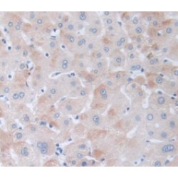 Peroxisome Proliferator Activated Receptor Delta (PPARd) Antibody