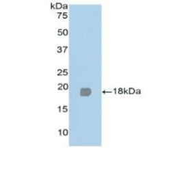 Peroxisome Proliferator Activated Receptor Gamma (PPARg) Antibody