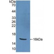 Western blot analysis of recombinant Human PPARg.