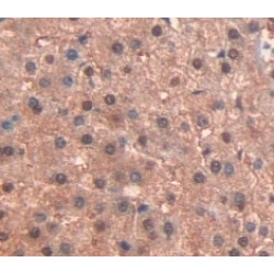 Peroxisome Proliferator Activated Receptor Gamma (PPARg) Antibody