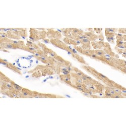 Peroxisome Proliferator Activated Receptor Gamma (PPARg) Antibody