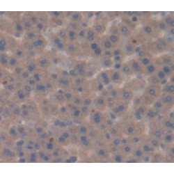 Peroxisome Proliferator Activated Receptor Gamma (PPARg) Antibody