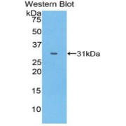 Western blot analysis of the recombinant protein.