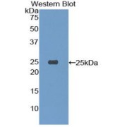 abx104521