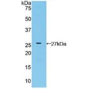 abx104527