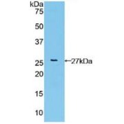 Western blot analysis of recombinant Human FGFRL1.