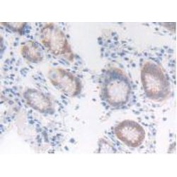 Fibroblast Growth Factor Receptor Like Protein 1 (FGFRL1) Antibody
